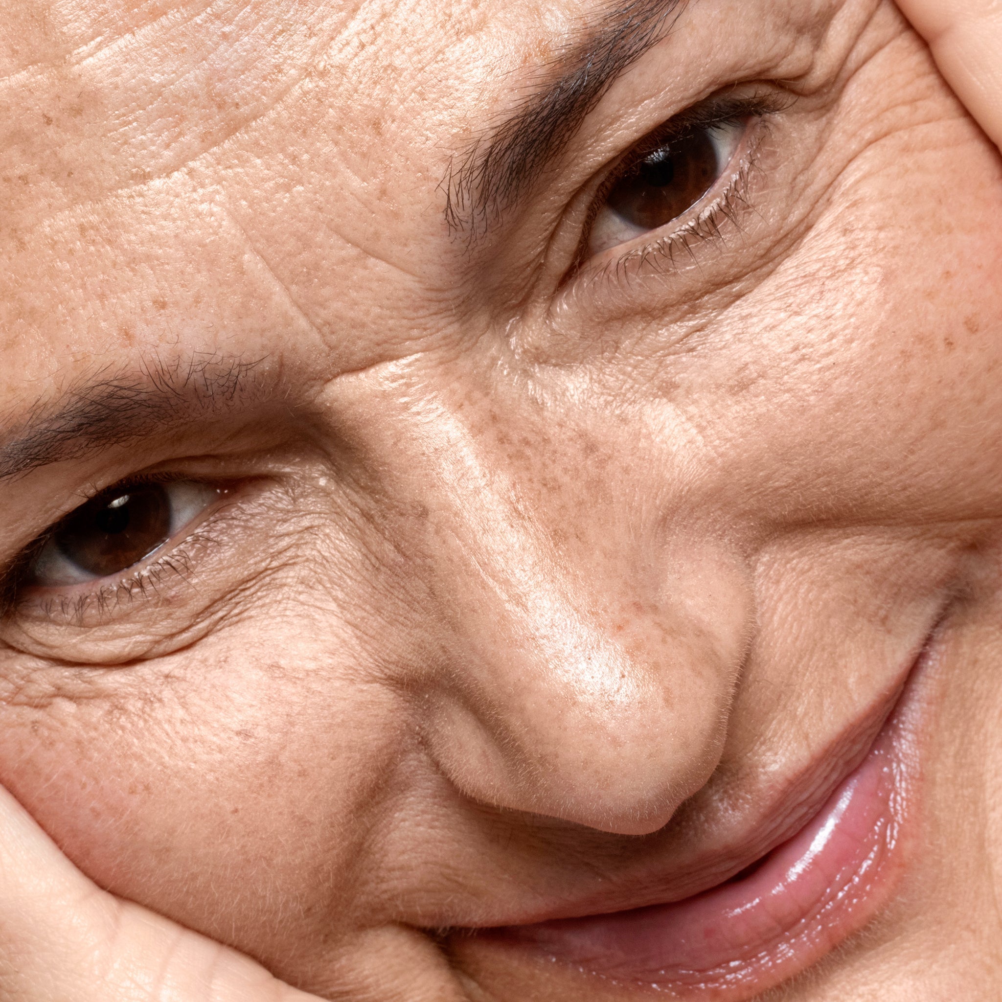 Cómo Tratar Lentigos Solares con Aloe Vera