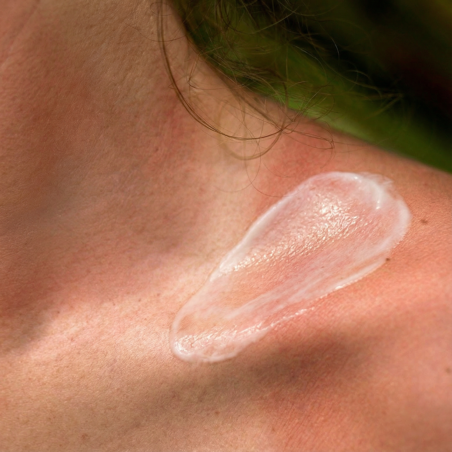 Quemaduras solares: Trátalas de forma natural con Aloe Vera